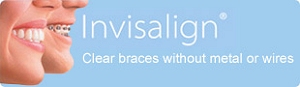 Invisalign